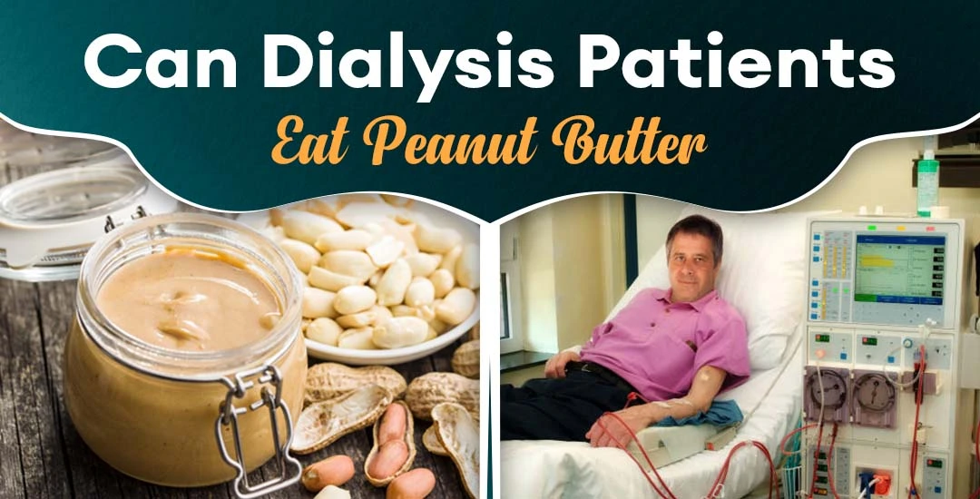 Can Dialysis Patients Eat Peanut Butter?